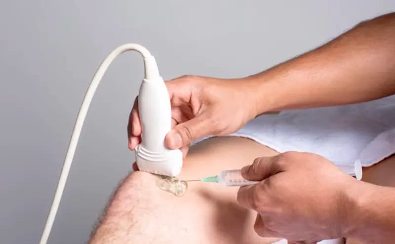 Ultrasound Guided Injection