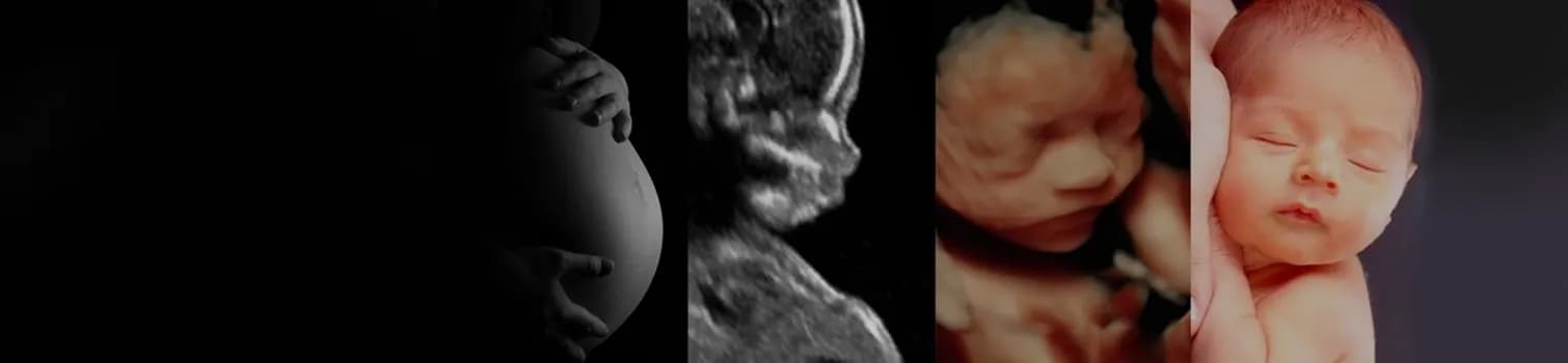 3D Scan