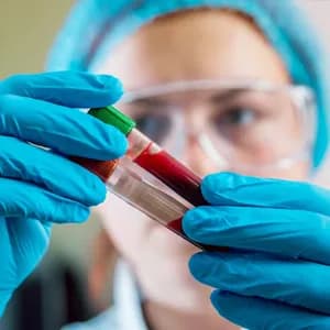 Clinical Blood Tests
