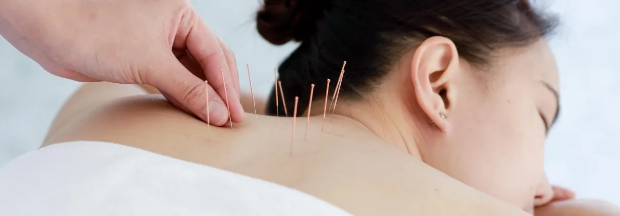Acupuncture in walsall