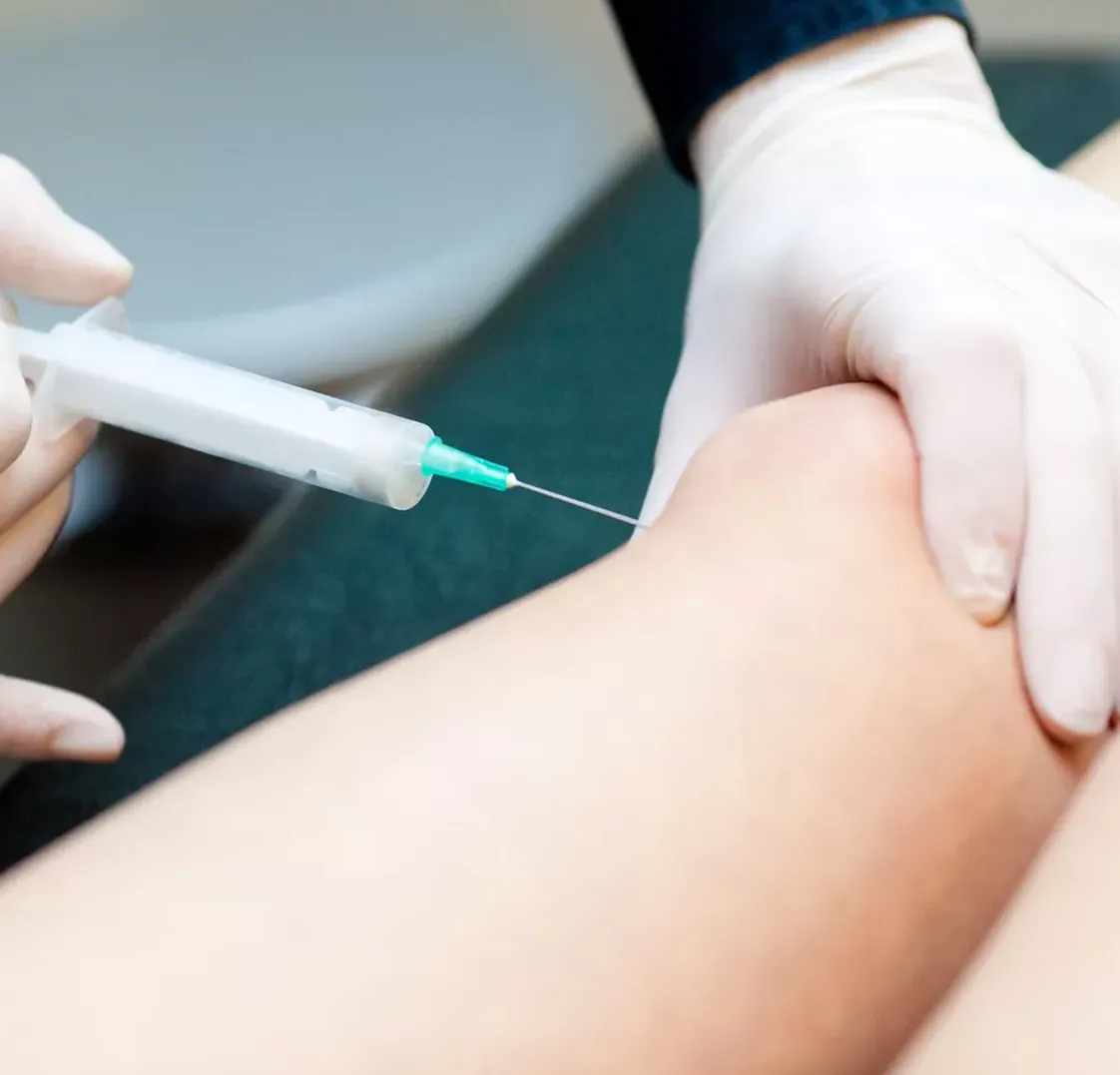 Injection physiotherapy