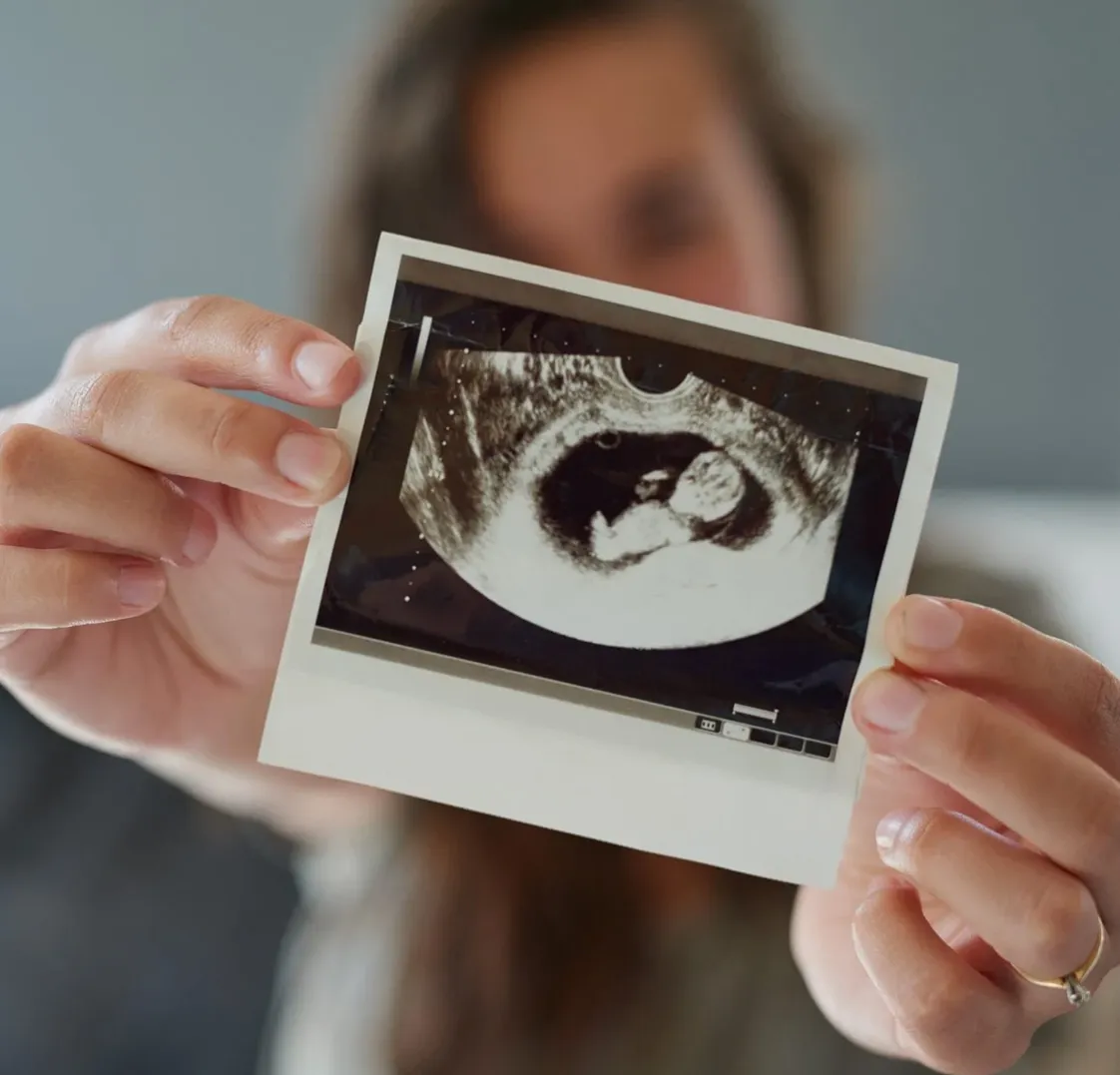 Benefits of anomaly scan in insight health services
