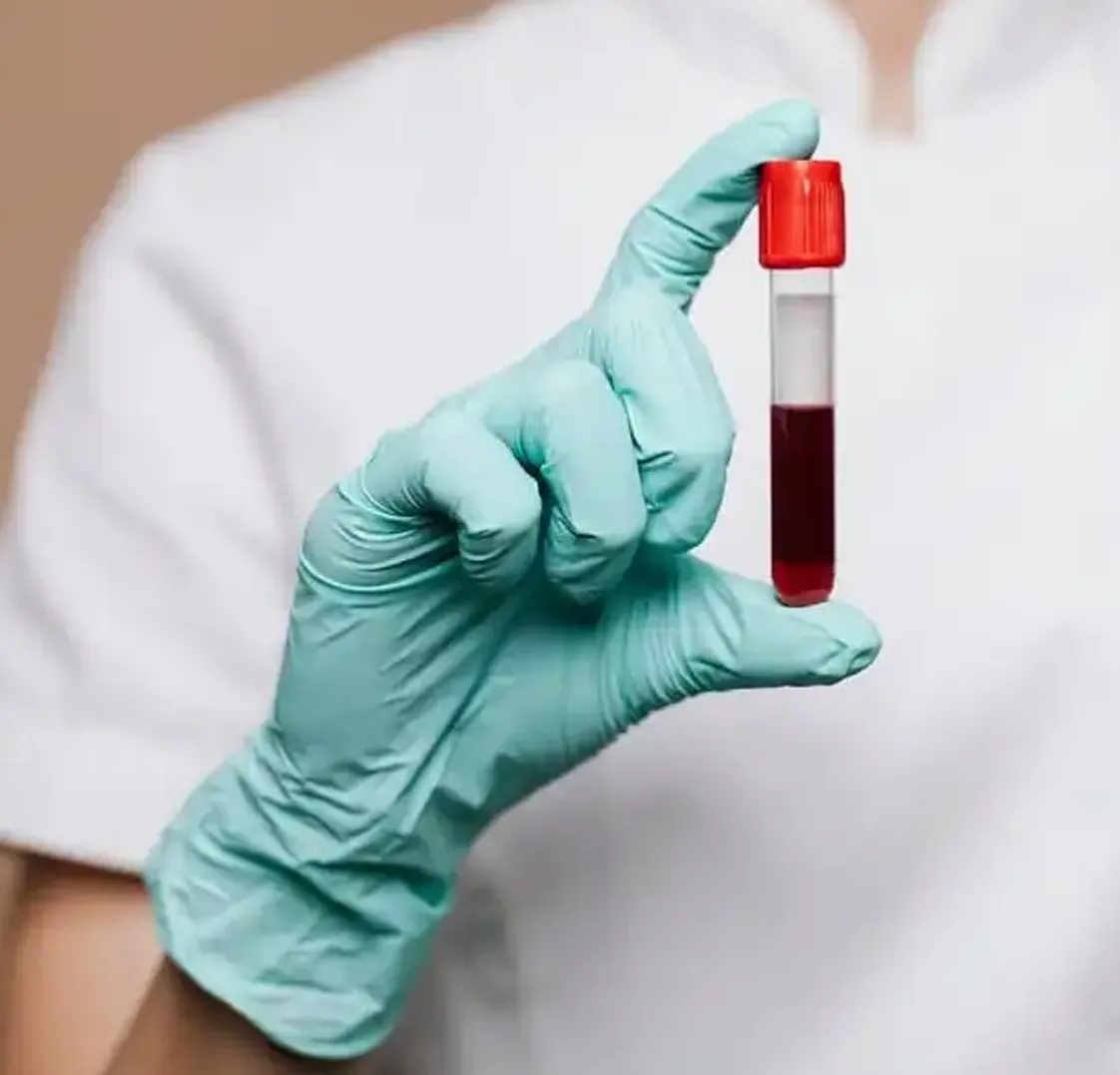Routine-Special Blood Test